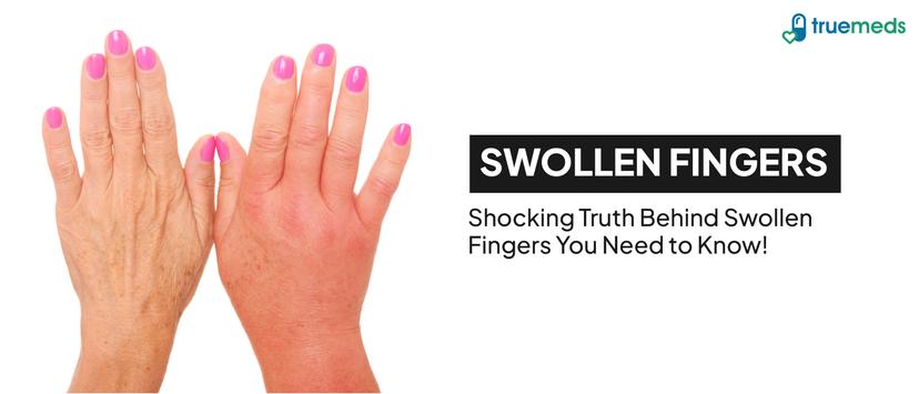 Visual Reference: Itchy Skin Causes Symptoms Relief Options